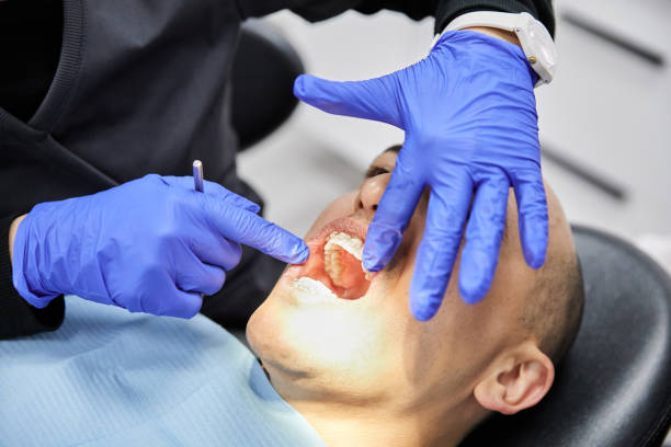 Best Emergency Treatment for Oral Infections in Snellville, GA